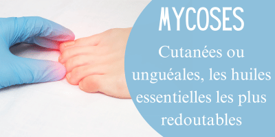 Mycoses cutan&eacute;es ou ungu&eacute;ales, les huiles essentielles les plus redoutables